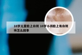 10岁儿童脸上白斑 10岁小孩脸上有白斑块怎么回事