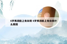 6岁男孩脸上有白斑 6岁男孩脸上有白斑什么原因