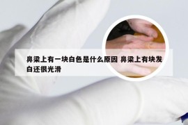 鼻梁上有一块白色是什么原因 鼻梁上有块发白还很光滑