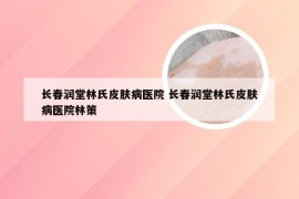 长春润堂林氏皮肤病医院 长春润堂林氏皮肤病医院林策