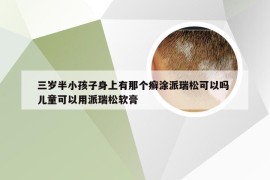 三岁半小孩子身上有那个癣涂派瑞松可以吗 儿童可以用派瑞松软膏