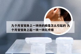 九个月宝宝身上一块块的癣是怎么引起的 九个月宝宝身上起一块一块红疙瘩