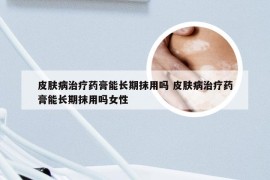 皮肤病治疗药膏能长期抹用吗 皮肤病治疗药膏能长期抹用吗女性