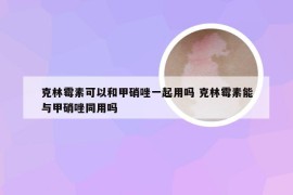 克林霉素可以和甲硝唑一起用吗 克林霉素能与甲硝唑同用吗