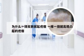 为什么一挠皮肤就起疙瘩 一痒一挠就出现凸起的疙瘩