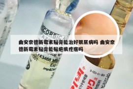 曲安奈德新霉素贴膏能治好银屑病吗 曲安奈德新霉素贴膏能贴疤痕疙瘩吗