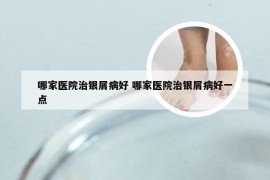哪家医院治银屑病好 哪家医院治银屑病好一点