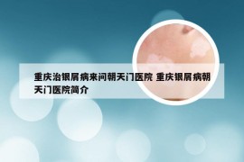 重庆治银屑病来问朝天门医院 重庆银屑病朝天门医院简介