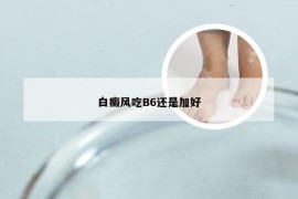 白癜风吃B6还是加好