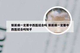 银屑病一定要中西医结合吗 银屑病一定要中西医结合吗知乎
