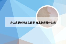 身上皮肤刺痒怎么回事 身上刺痒是什么病