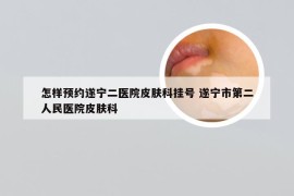 怎样预约遂宁二医院皮肤科挂号 遂宁市第二人民医院皮肤科