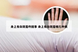 身上有白斑是咋回事 身上有白斑是哪几种病