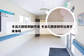 卡泊三醇搽剂副作用 卡泊三醇搽剂可以用于身体吗