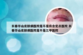 长春华山皮肤病医院是不是农合定点医院 长春华山皮肤病医院是不是三甲医院