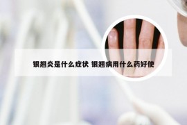 银翘炎是什么症状 银翘病用什么药好使