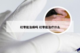 红枣能治癣吗 红枣能治疗什么