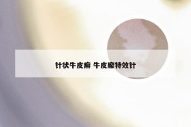 针状牛皮癣 牛皮廨特效针
