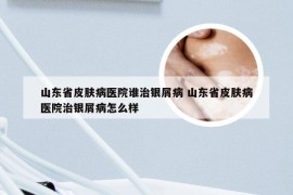 山东省皮肤病医院谁治银屑病 山东省皮肤病医院治银屑病怎么样