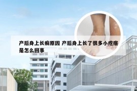 产后身上长癣原因 产后身上长了很多小疙瘩是怎么回事