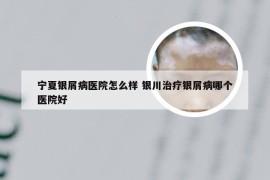 宁夏银屑病医院怎么样 银川治疗银屑病哪个医院好