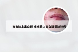 宝宝脸上出白斑 宝宝脸上出白斑是缺锌吗