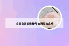 白斑自己能恢复吗 白斑能治愈吗