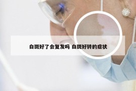 白斑好了会复发吗 白斑好转的症状