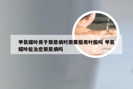 甲氨蝶呤用于银屑病时需要服用叶酸吗 甲氨蝶呤能治愈银屑病吗