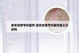 南京皮肤专科医院 南京皮肤专科医院是公立的吗