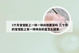 3个月宝宝脸上一块一块白斑要紧吗 三个月的宝宝脸上有一块块白的是怎么回事