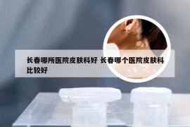 长春哪所医院皮肤科好 长春哪个医院皮肤科比较好