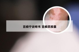 百癣宁说明书 百癣灵胶囊