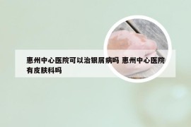 惠州中心医院可以治银屑病吗 惠州中心医院有皮肤科吗