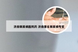 济南银屑病医院药 济南著名银屑病专家