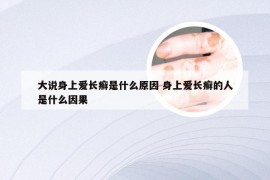 大说身上爱长癣是什么原因 身上爱长癣的人是什么因果