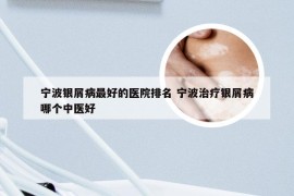 宁波银屑病最好的医院排名 宁波治疗银屑病哪个中医好