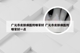 广元市皮肤病医院哪家好 广元市皮肤病医院哪家好一点