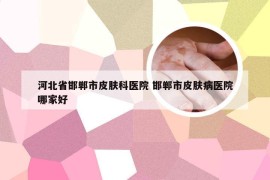 河北省邯郸市皮肤科医院 邯郸市皮肤病医院哪家好
