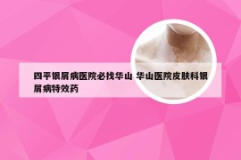 四平银屑病医院必找华山 华山医院皮肤科银屑病特效药