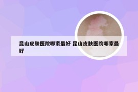 昆山皮肤医院哪家最好 昆山皮肤医院哪家最好