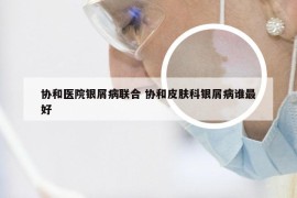 协和医院银屑病联合 协和皮肤科银屑病谁最好