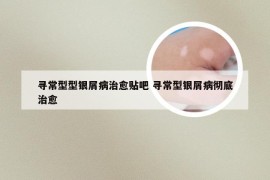寻常型型银屑病治愈贴吧 寻常型银屑病彻底治愈