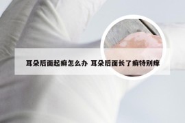 耳朵后面起癣怎么办 耳朵后面长了癣特别痒