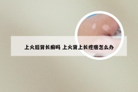 上火后背长癣吗 上火背上长疙瘩怎么办