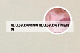 婴儿肚子上有块白斑 婴儿肚子上有个白色的斑