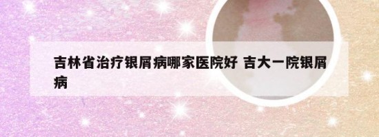吉林省治疗银屑病哪家医院好 吉大一院银屑病
