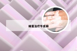 蜂蜜治疗牛皮癣