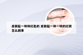 皮肤起一块块红色的 皮肤起一块一块的红斑怎么回事