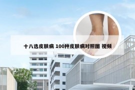十八选皮肤病 100种皮肤病对照图 视频